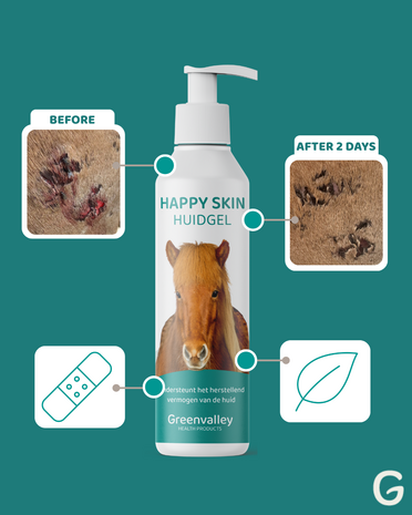 Happy Skin Huidgel &ndash; Intensieve verzorging bij zomerse kriebel